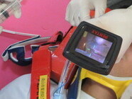 ビデオ喉頭鏡