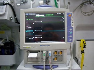 患者監視装置（モニター）の写真